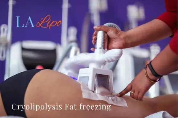 women getting fat freezing Walthamstow