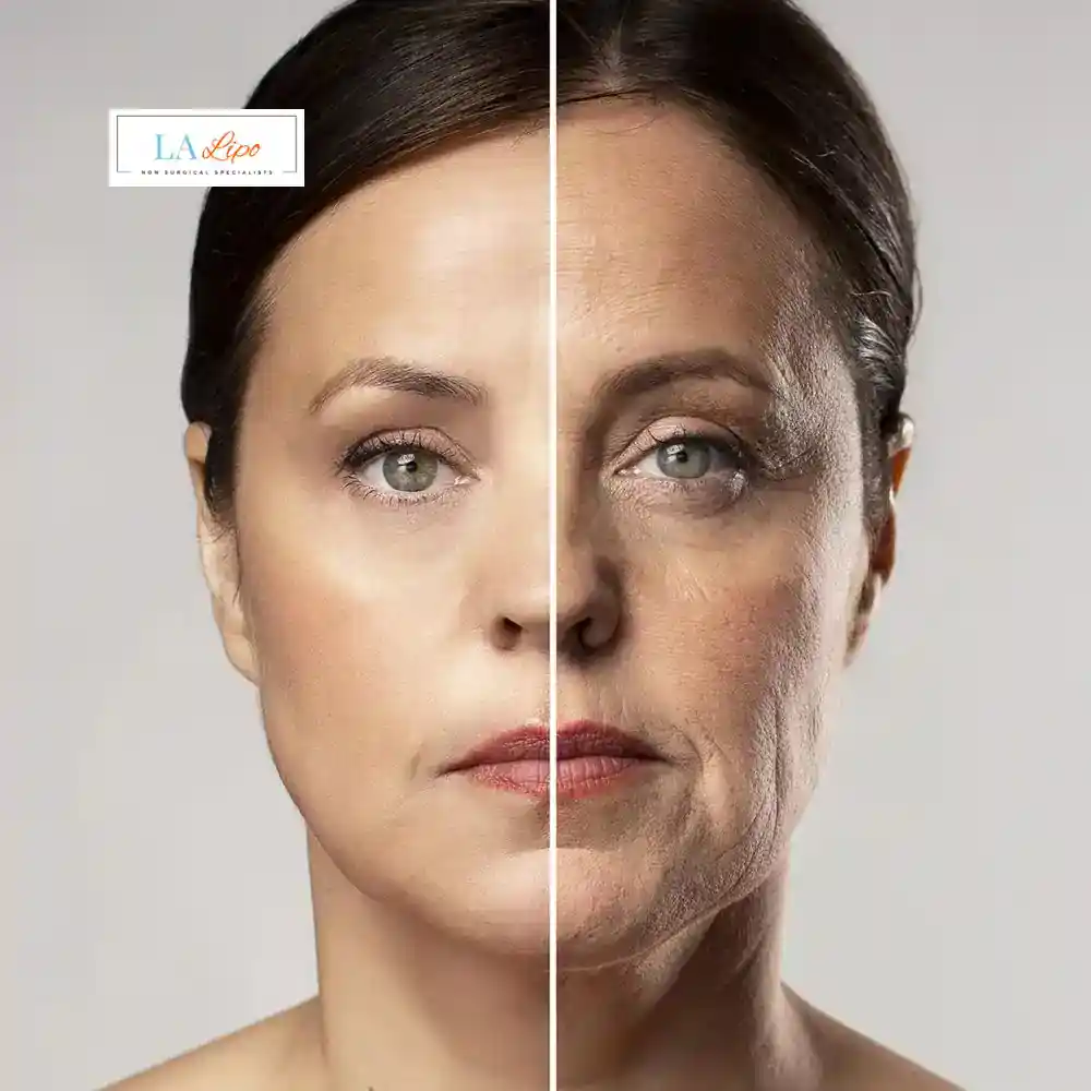 How Can You Tell If Non-Surgical Skin Tightening Is Right for You Walthamstow?